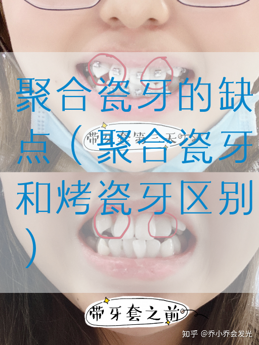 聚合瓷牙的缺点（聚合瓷牙和烤瓷牙区别）(图1)