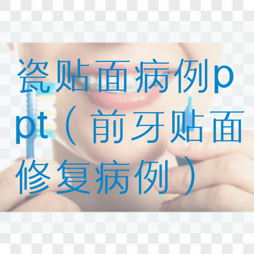 瓷贴面病例*（前牙贴面修复病例）