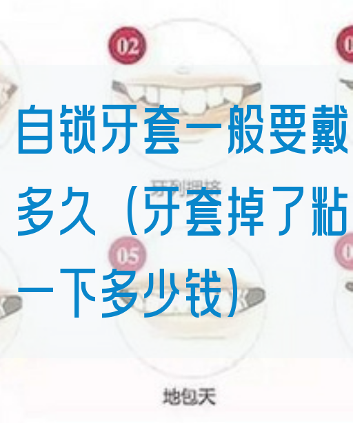 自锁牙套一般要戴多久（牙套掉了粘一下多少钱）(图1)