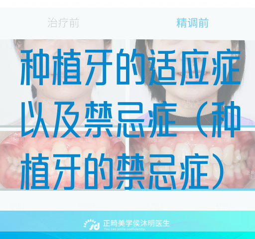 种植牙的适应症以及禁忌症（种植牙的禁忌症）(图1)