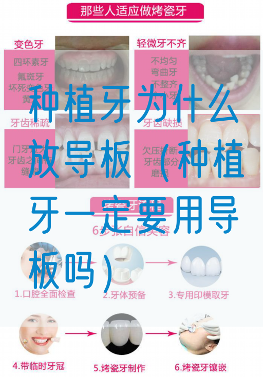 种植牙为什么放导板（种植牙一定要用导板吗）(图1)