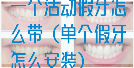 一个活动假牙怎么带（单个假牙怎么安装）(图1)