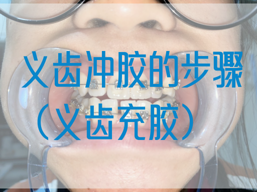 义齿冲胶的步骤（义齿充胶）(图1)