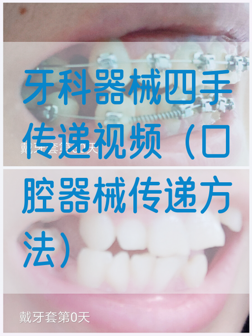牙科器械四手传递视频（口腔器械传递方法）(图1)