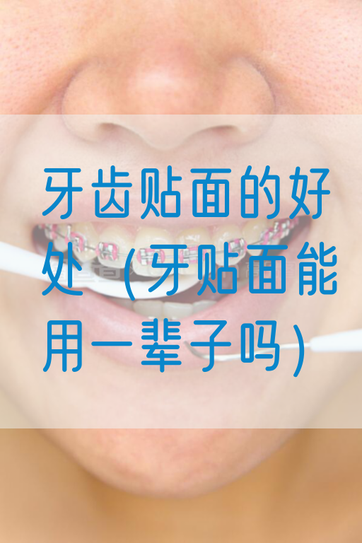 牙齿贴面的好处（牙贴面能用一辈子吗）(图1)