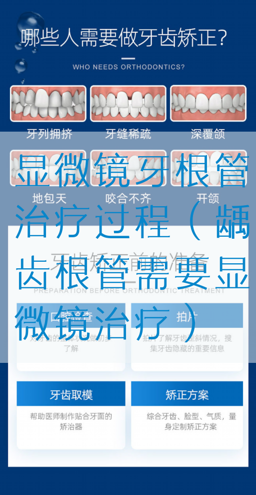 显微镜牙根管治疗过程（龋齿根管需要显微镜治疗）(图1)