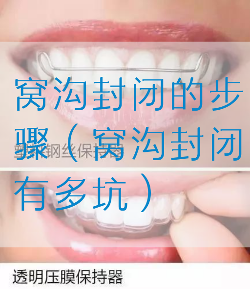 窝沟封闭的步骤（窝沟封闭有多坑）(图1)