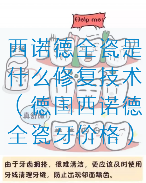 西诺德全瓷是什么修复技术（德国西诺德全瓷牙价格）(图1)