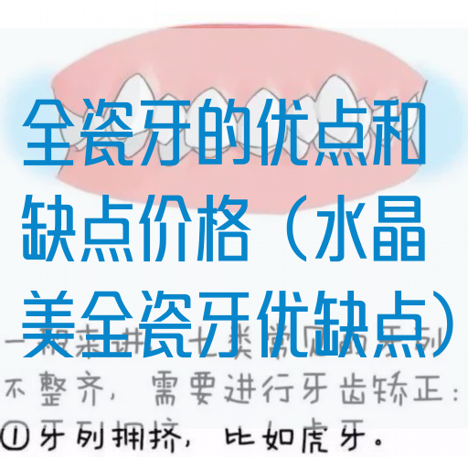 全瓷牙的优点和缺点价格（水晶美全瓷牙优缺点）(图1)