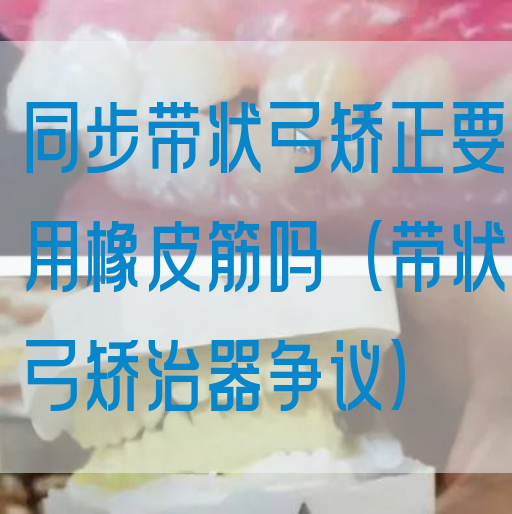 同步带状弓矫正要用橡*筋吗（带状弓矫治器争议）(图1)