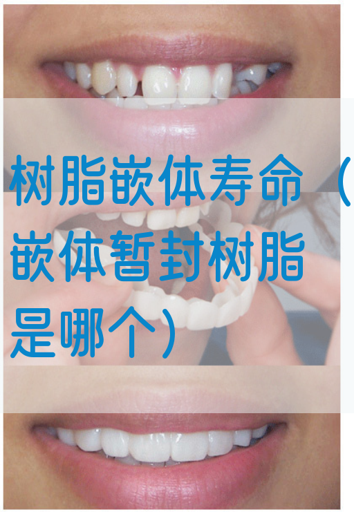 树脂嵌体寿命（嵌体暂封树脂是哪个）(图1)