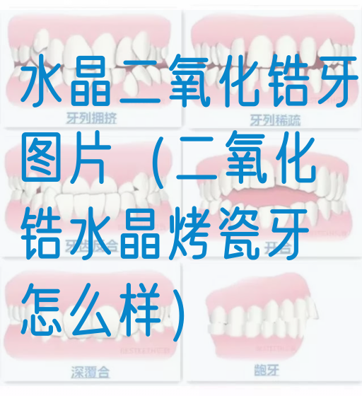 水晶二氧化锆牙图片（二氧化锆水晶烤瓷牙怎么样）(图1)