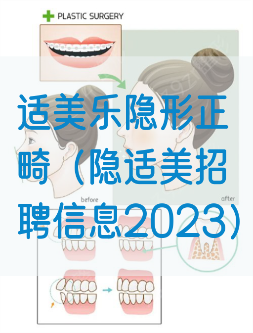 适美乐隐形正畸（隐适美*信息2023）(图1)