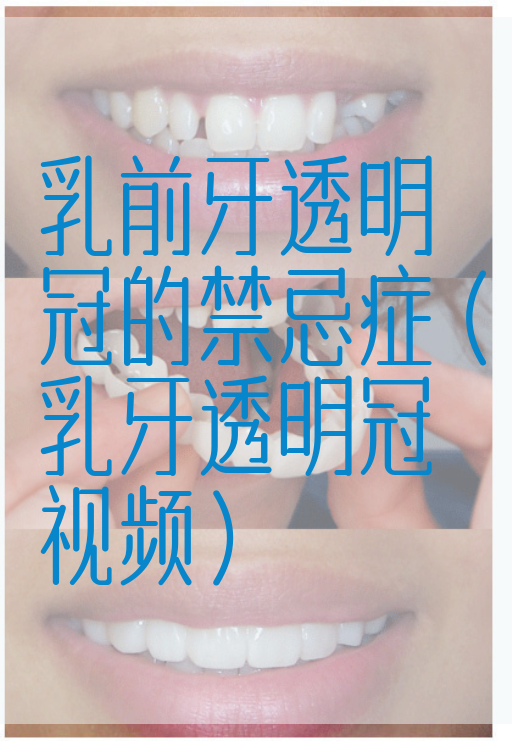 乳前牙透明冠的禁忌症（乳牙透明冠视频）(图1)