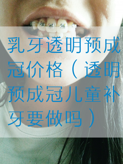 乳牙透明预成冠价格（透明预成冠儿童补牙要做吗）(图1)