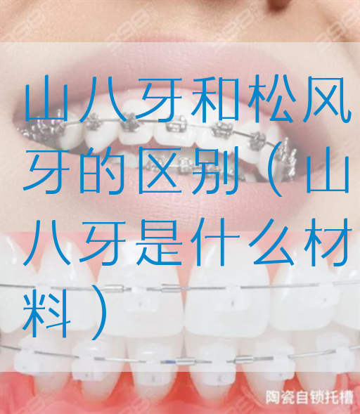 山八牙和松风牙的区别（山八牙是什么材料）(图1)
