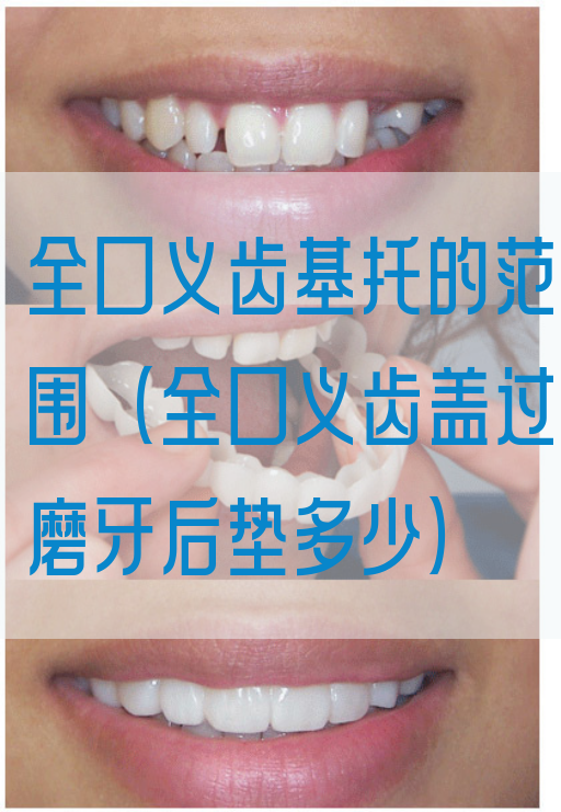 全口义齿基托的范围（全口义齿盖过磨牙后垫多少）(图1)