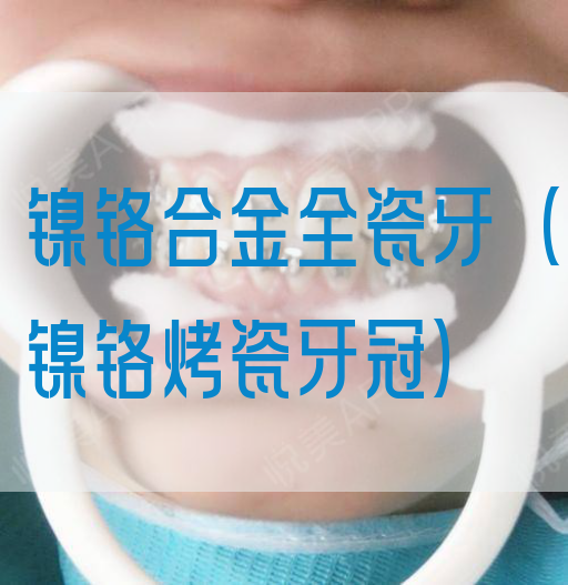 镍铬合金全瓷牙（镍铬烤瓷牙冠）(图1)