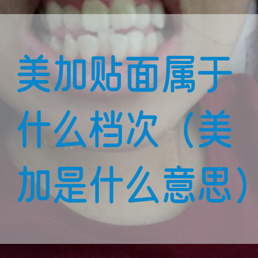 美加贴面属于什么档次（美加是什么意思）(图1)