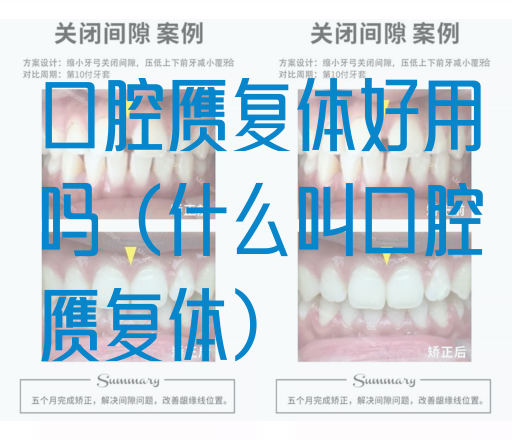 口腔赝复体好用吗（什么叫口腔赝复体）(图1)