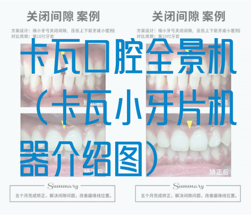 卡瓦口腔全景机（卡瓦小牙片机器介绍图）(图1)