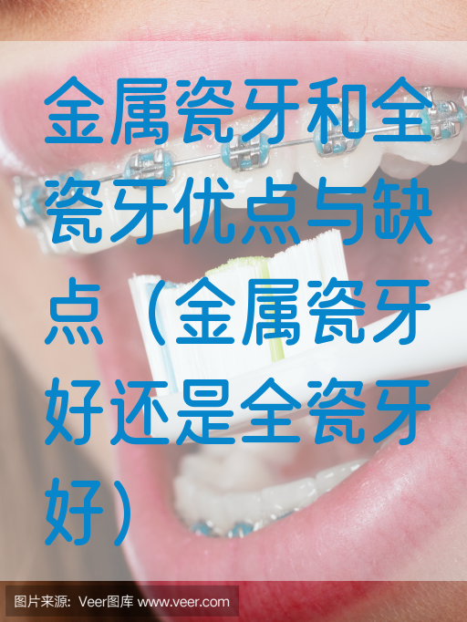 金属瓷牙和全瓷牙优点与缺点（金属瓷牙好还是全瓷牙好）(图1)