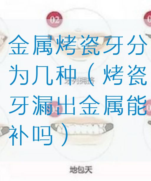 金属烤瓷牙分为几种（烤瓷牙漏出金属能补吗）(图1)
