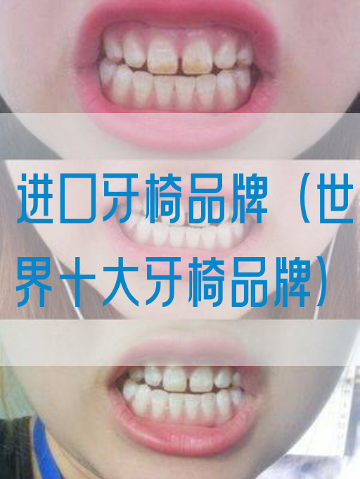 进口牙椅品牌（世界*牙椅品牌）(图1)