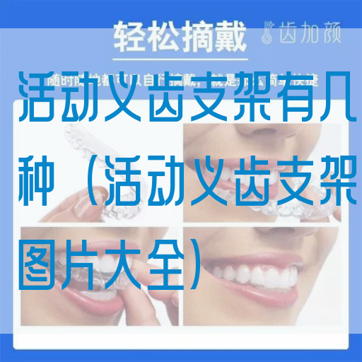 活动义齿支架有几种（活动义齿支架图片大全）(图1)