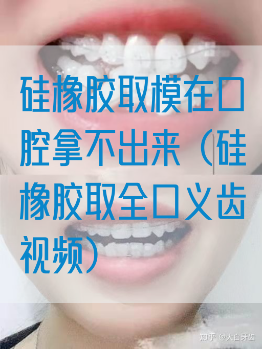 硅橡胶取模在口腔拿不出来（硅橡胶取全口义齿视频）(图1)