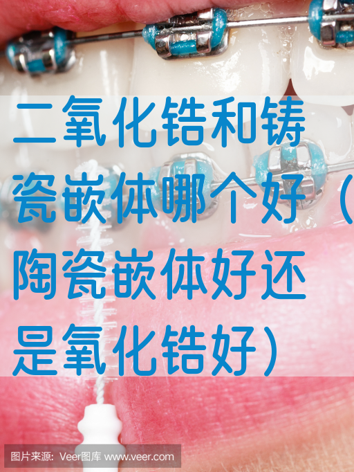 二氧化锆和铸瓷嵌体哪个好（陶瓷嵌体好还是氧化锆好）(图1)