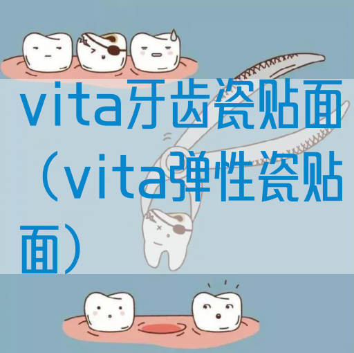 vita牙齿瓷贴面（vita弹性瓷贴面）(图1)
