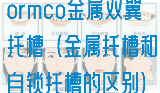 ormco金属双翼托槽（金属托槽和自锁托槽的区别）(图1)