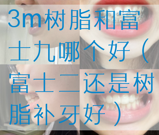 3m树脂和富士九哪个好（富士二还是树脂补牙好）(图1)