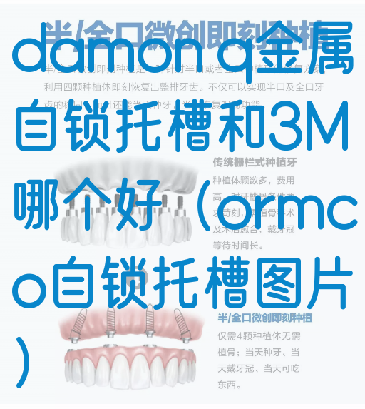 damon q金属自锁托槽和3M哪个好（ormco自锁托槽图片）(图1)