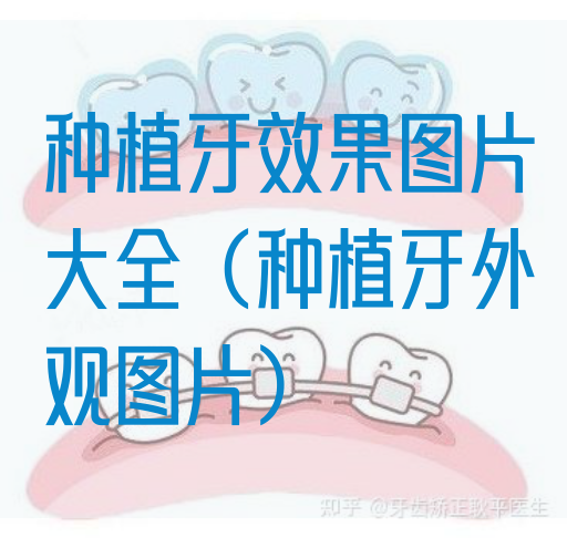 种植牙*片大全（种植牙外观图片）