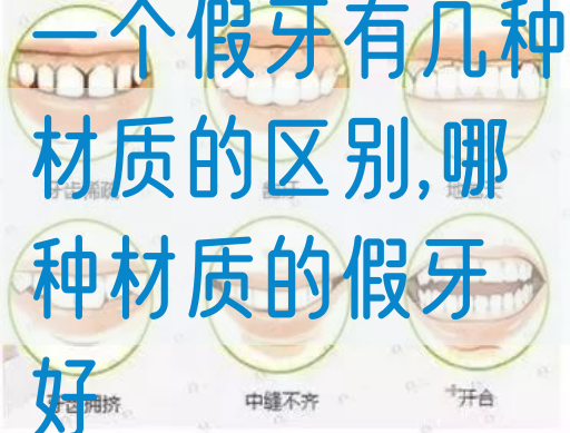 一个假牙有几种材质的区别,哪种材质的假牙好