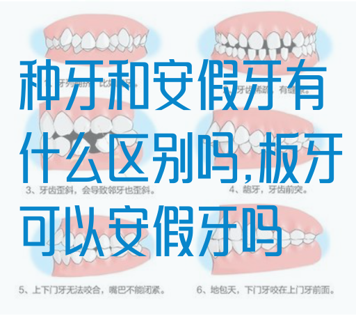 种牙和安假牙有什么区别吗,板牙可以安假牙吗