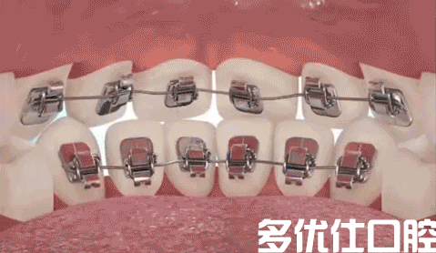 石门人有“口”福啦！0元涂氟、58元洁牙、68元拔牙…快来薅羊毛~(图8)