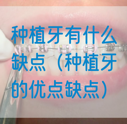 种植牙有什么缺点（种植牙的优点缺点）
