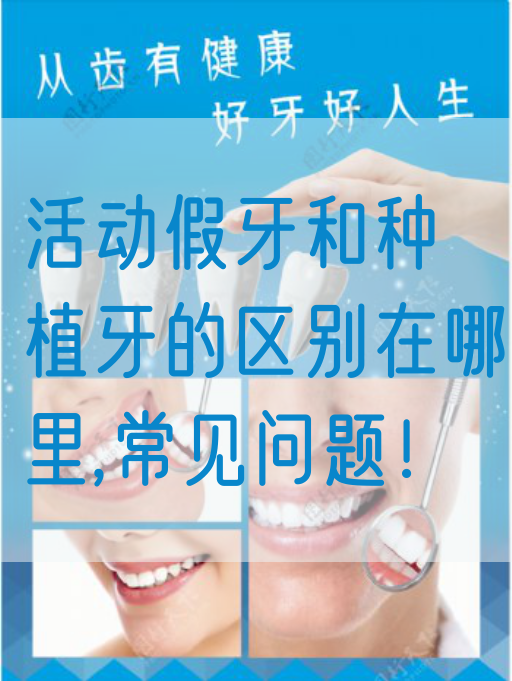 活动假牙和种植牙的区别在哪里,常见问题！