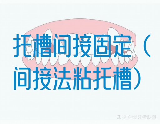 托槽间接固定（间接法粘托槽）