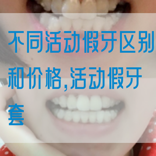 不同活动假牙区别和价格,活动假牙套