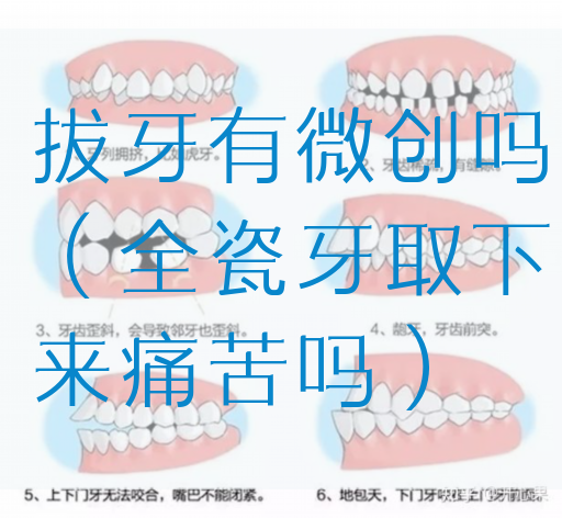 拔牙有微创吗（全瓷牙取下来痛苦吗）