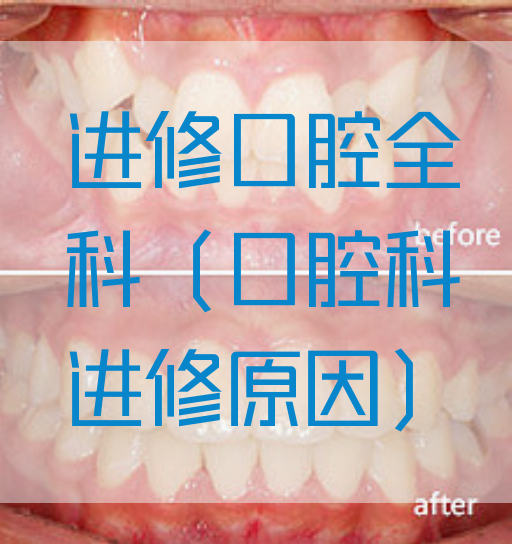 进修口腔全科（口腔科进修原因）