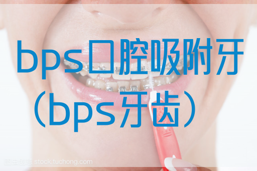 bps口腔吸附牙（bps牙齿）