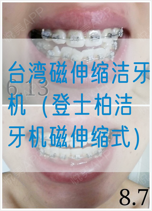 台湾磁伸缩洁牙机（登士柏洁牙机磁伸缩式）