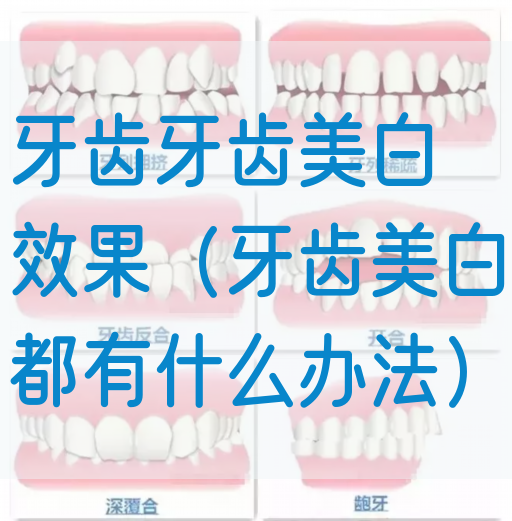 牙齿牙齿美白效果（牙齿美白都有什么办法）