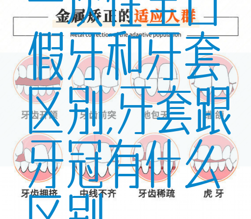 一次性全口假牙和牙套区别,牙套跟牙冠有什么区别