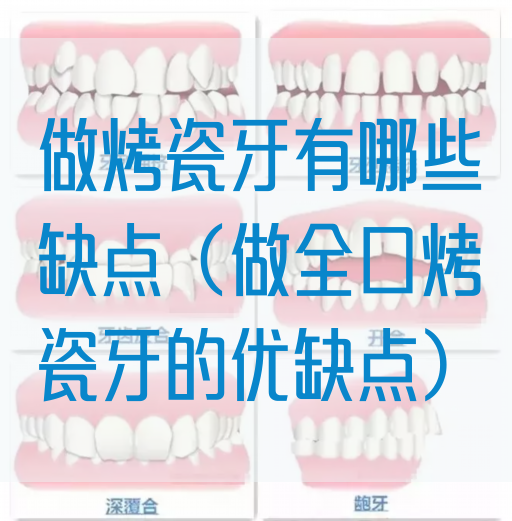 做烤瓷牙有哪些缺点（做全口烤瓷牙的优缺点）